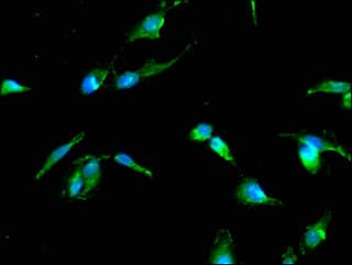 Polyclonal Rabbit anti-Human TP53I11 / PIG11 Antibody (IF)