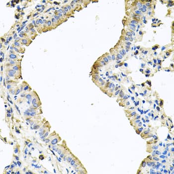 Polyclonal Rabbit anti-Human CHCHD3 Antibody (IHC, WB)