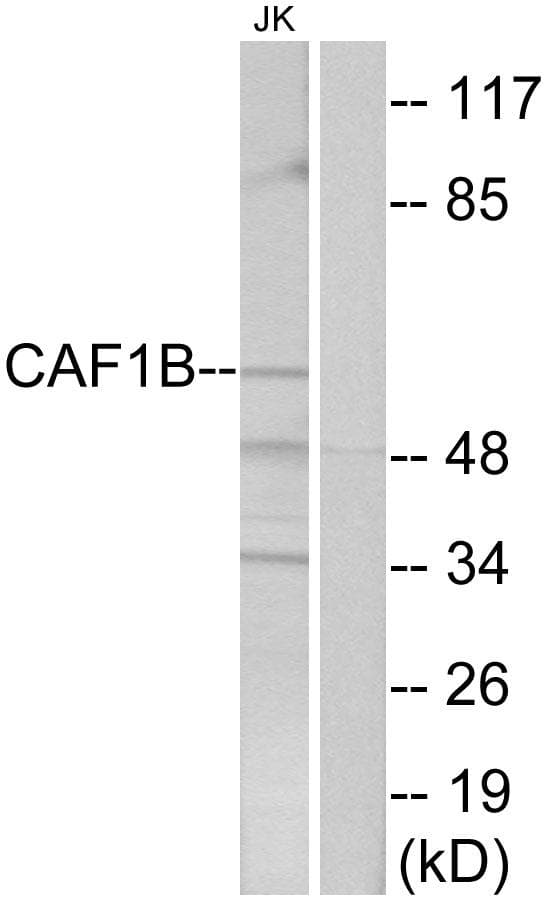 Polyclonal Rabbit anti-Human CHAF1B / CAF1 Antibody (WB)
