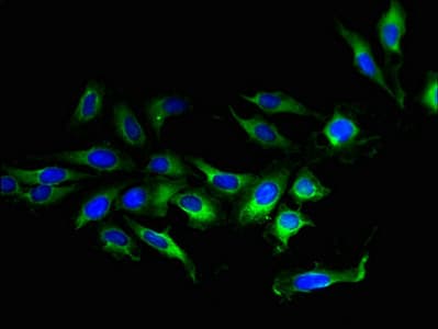 Polyclonal Rabbit anti-Human TMEM207 Antibody