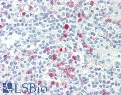 IHC-plus™ CD177 Antibody