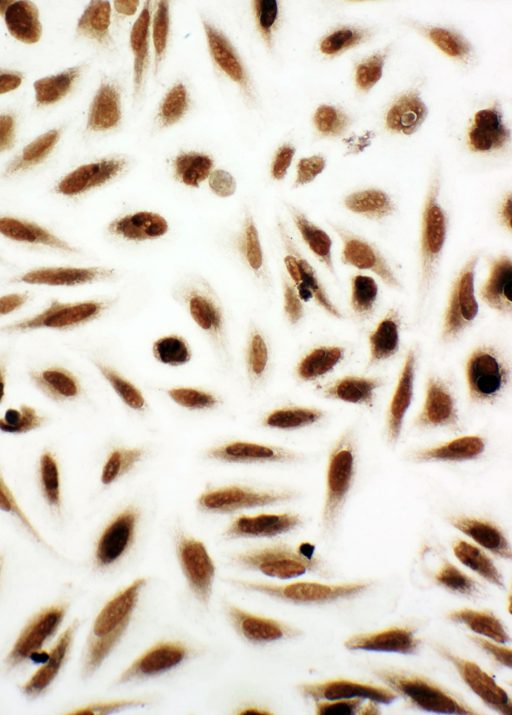 NME2 Antibody (aa137-152)