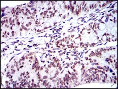 BMI1 / PCGF4 Antibody (clone 3000)