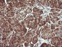 Monoclonal Mouse anti-Human MAP2K3 / MEK3 / MKK3 Antibody (clone OTI5B2, IHC, IF, WB)
