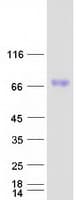 Human SCARB1 / SR-BI Protein (Recombinant Myc-DDK (Flag))