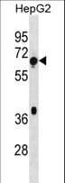 Polyclonal Rabbit anti-Human TBC1D3F Antibody (aa318-346, WB)