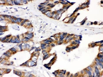 DLD / Diaphorase / E3 Antibody