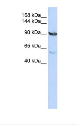 Polyclonal Rabbit anti-Human MTHFD1 Antibody (aa74-123, IHC, WB)