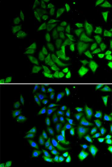 PIWIL1 / PIWI Antibody