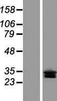 CLRN3 Protein (Over-Expression Lysate Myc-DDK (Flag))
