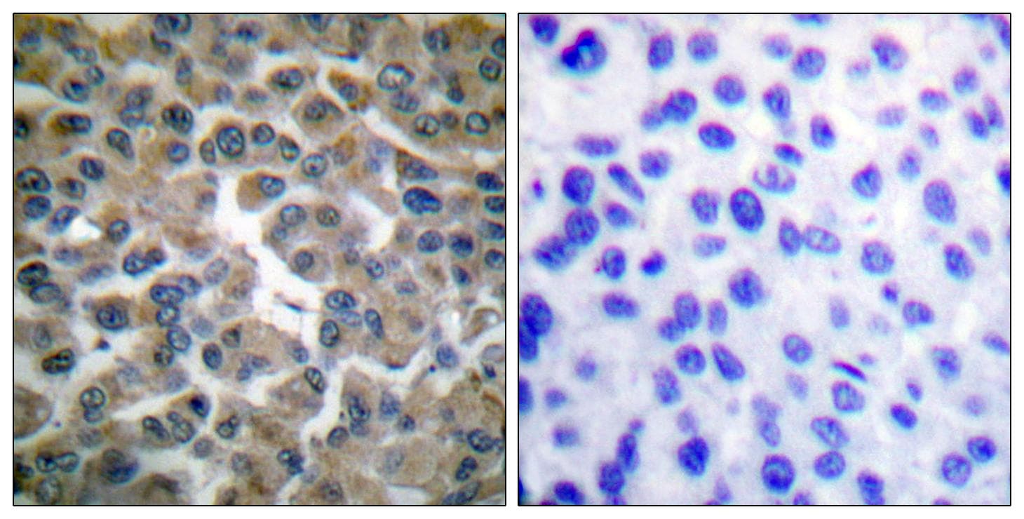 Polyclonal Rabbit anti-Human NFKBIE / IKB Epsilon Antibody (p22, IHC, IF, WB)