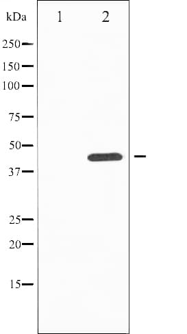 Polyclonal Rabbit anti-Human TH / Tyrosine Hydroxylase Antibody (phospho-Ser19, IHC, IF, WB)