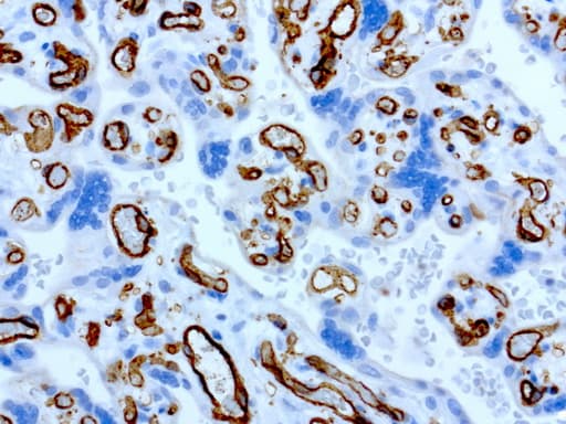 PECAM-1 / CD31 Antibody (clone UMAB164)