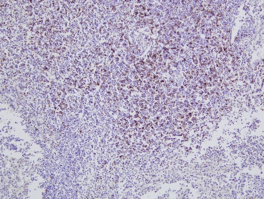 CD8 Antibody (clone CC63)