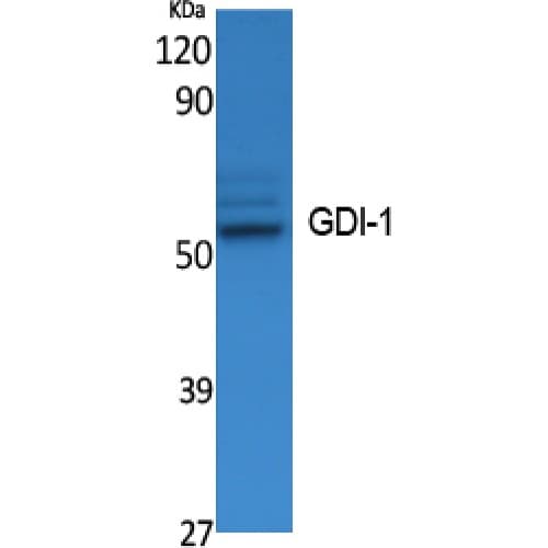 GDI1 Antibody (C-terminal)