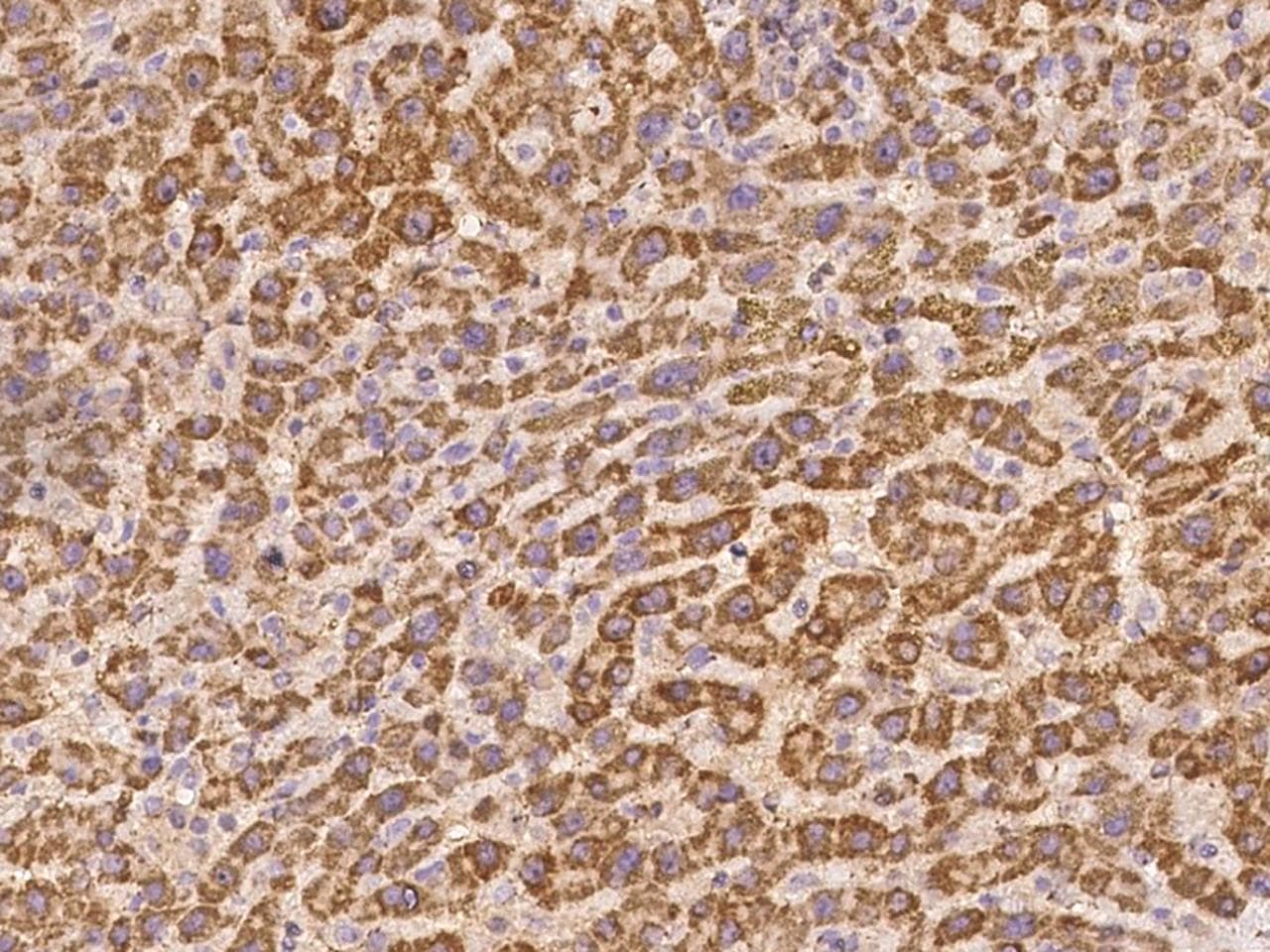 DPH5 Antibody