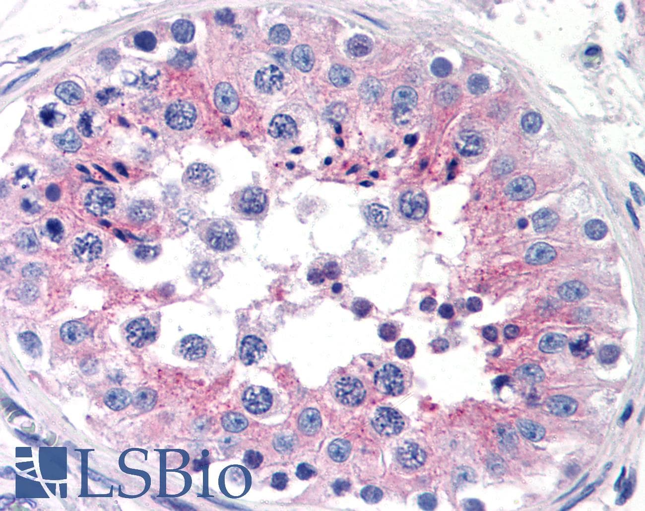 IHC-plus™ CLU / Clusterin Antibody (clone Hs-3)
