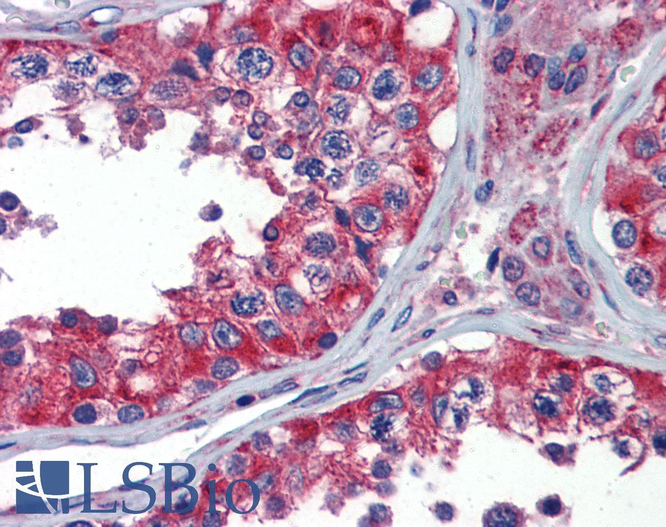 NPY1R Antibody (aa180-229)
