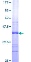 Human NOXO1 Protein (Recombinant GST, N-terminus)