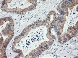 LCMT1 Antibody (clone OTI 1G5)