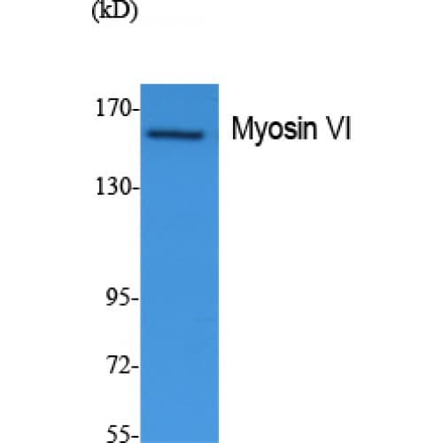 Polyclonal Rabbit anti-Human Myosin VI / MYO6 Antibody (40-120 aa, N-terminal, WB)