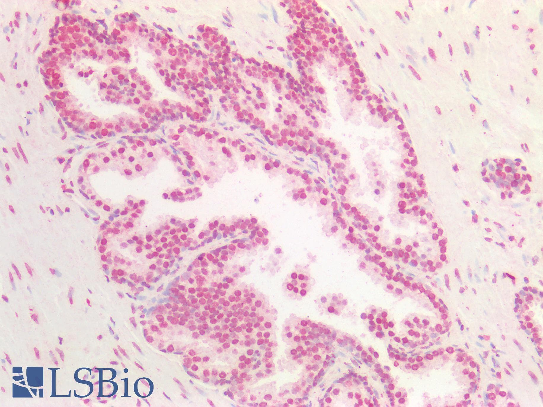 IHC-plus™ BMI1 / PCGF4 Antibody (aa303-315)
