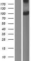 PDPR Protein (Over-Expression Lysate Myc-DDK (Flag))