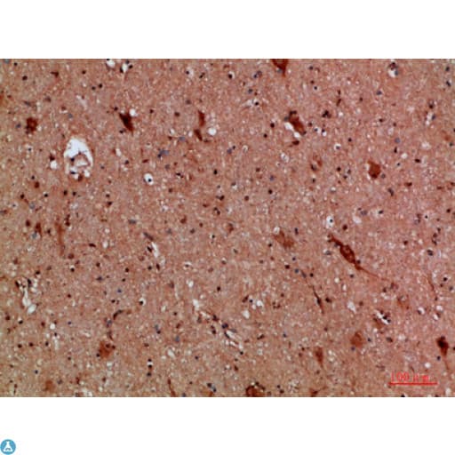 CALB2 / Calretinin Antibody