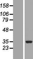 COQ3 Protein (Over-Expression Lysate Myc-DDK (Flag))