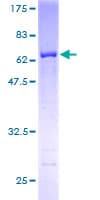 Human HSP90B1 / GP96 / GRP94 Protein (Recombinant GST)