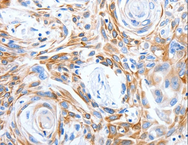 LRIG3 Antibody