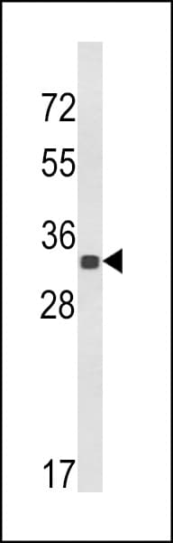 His Tag Antibody