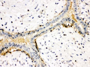 Polyclonal Rabbit anti-Human ACTA1 / Skeletal Muscle Actin Antibody (IHC, WB)