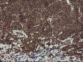 MME / CD10 Antibody (clone OTI3D11)