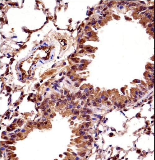 Polyclonal Rabbit anti-Mouse HOXC10 Antibody (aa217-246, IHC, WB)