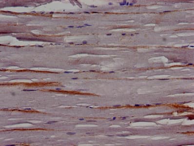 Polyclonal Rabbit anti-Human TRIP10 / CIP4 Antibody (IHC, IF)