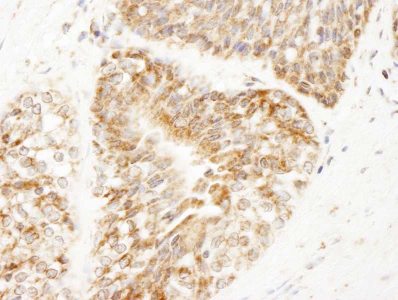 Polyclonal Rabbit anti-Human AKAP1 / AKAP Antibody (aa375-425, IHC, IF)