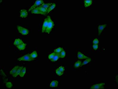 CHKA / CK / Choline Kinase Antibody