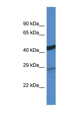 DGAT2 Antibody (aa208-257)