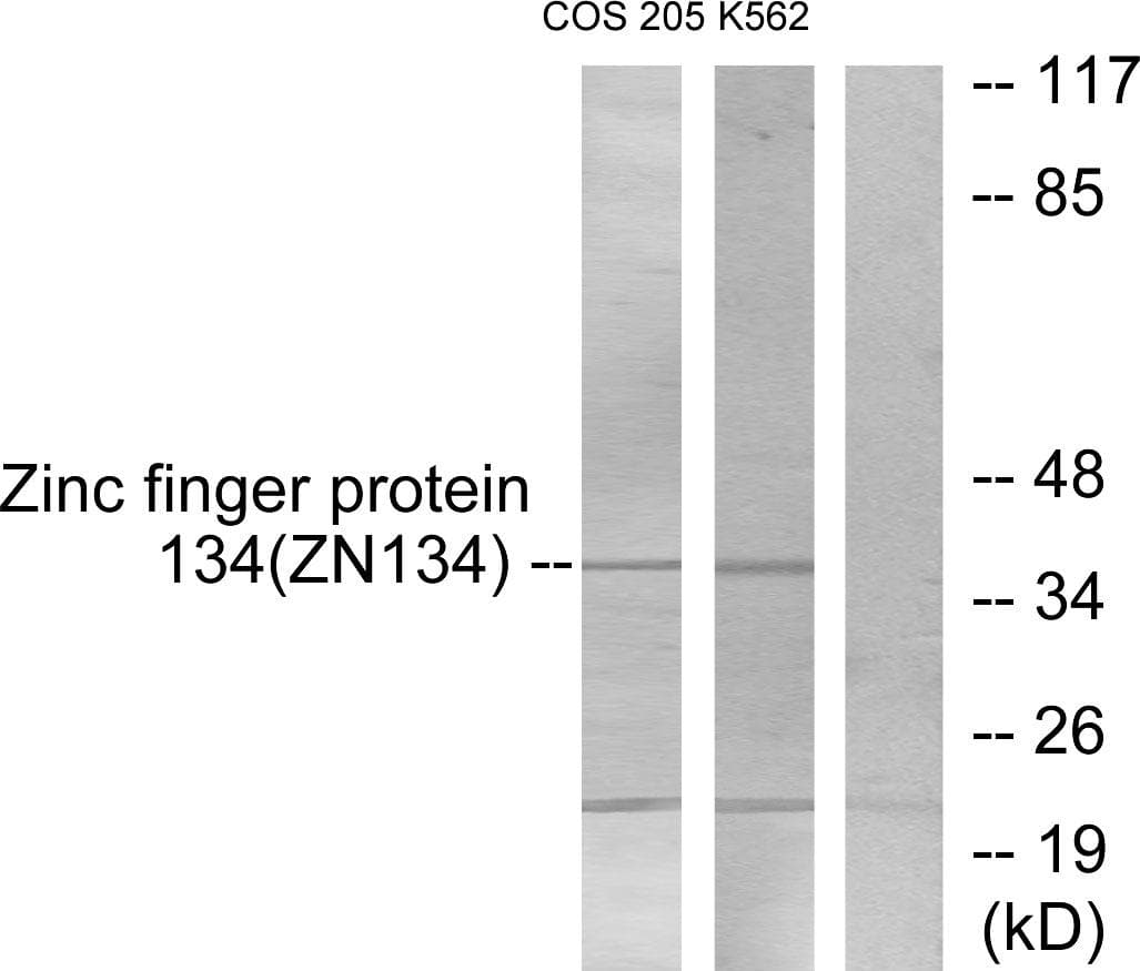 Polyclonal Rabbit anti-Human ZNF134 Antibody (WB)