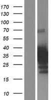 CITED4 Protein (Over-Expression Lysate Myc-DDK (Flag))