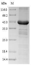 Human Growth Hormone Receptor / GHR Protein (Recombinant 6His-SUMO, N-terminus)