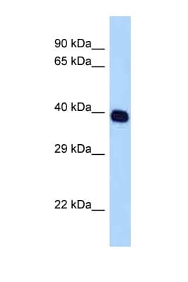 SELL / L-Selectin / CD62L Antibody (C-Terminus)