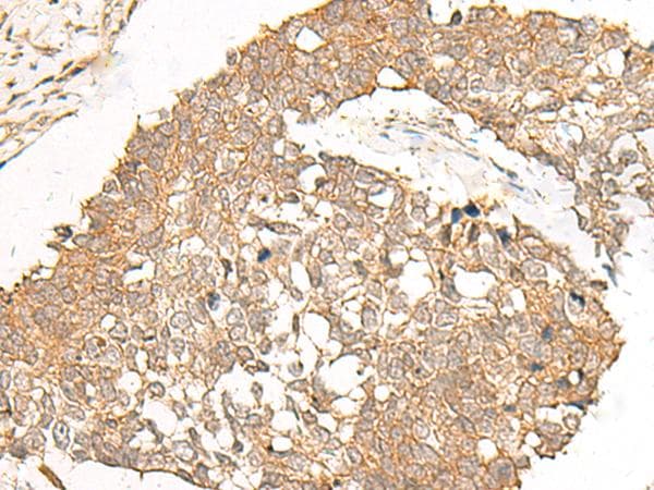 Polyclonal Rabbit anti-Human POLR2L Antibody (IHC)