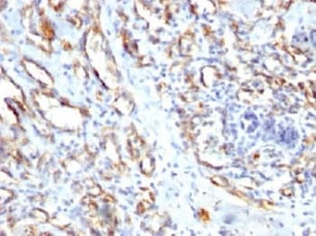 Polyclonal Rabbit anti-Human PECAM-1 / CD31 Antibody (Azide-free,BSA-free, IHC, IF)