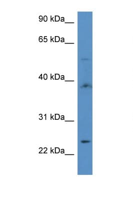 ACOT9 Antibody (aa356-405)
