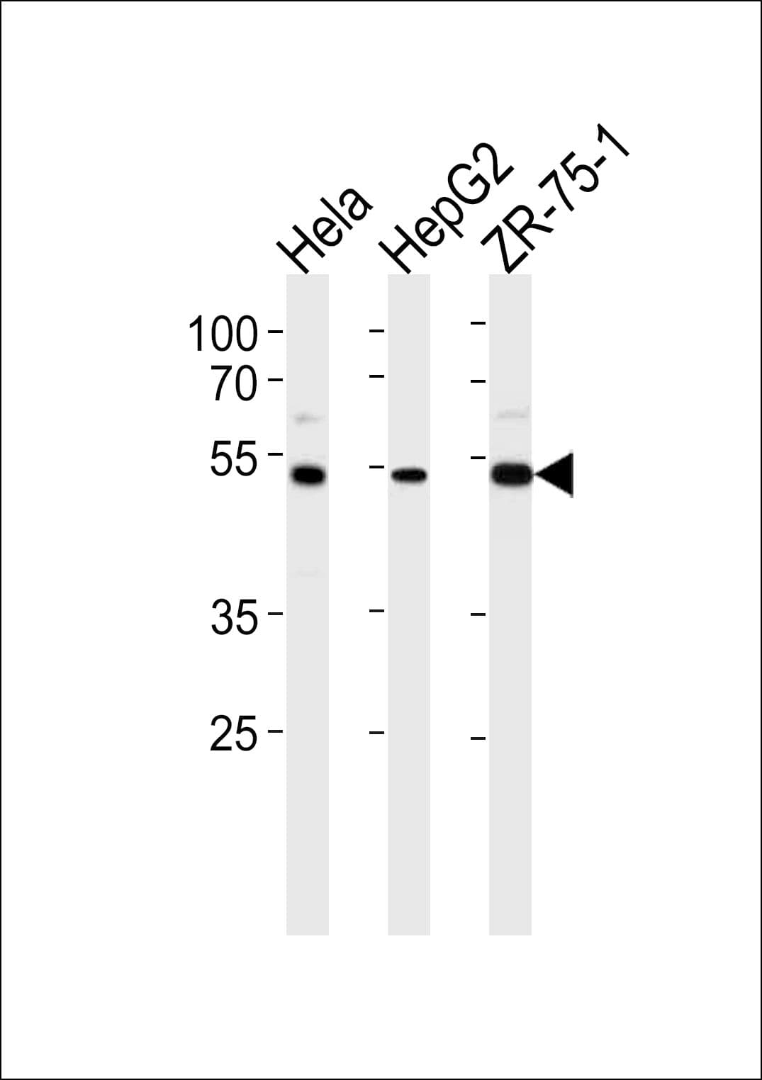 TERF2IP / RAP1 Antibody (aa349-378)