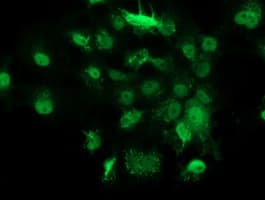 GSTT2 Antibody (clone OTI7A1)