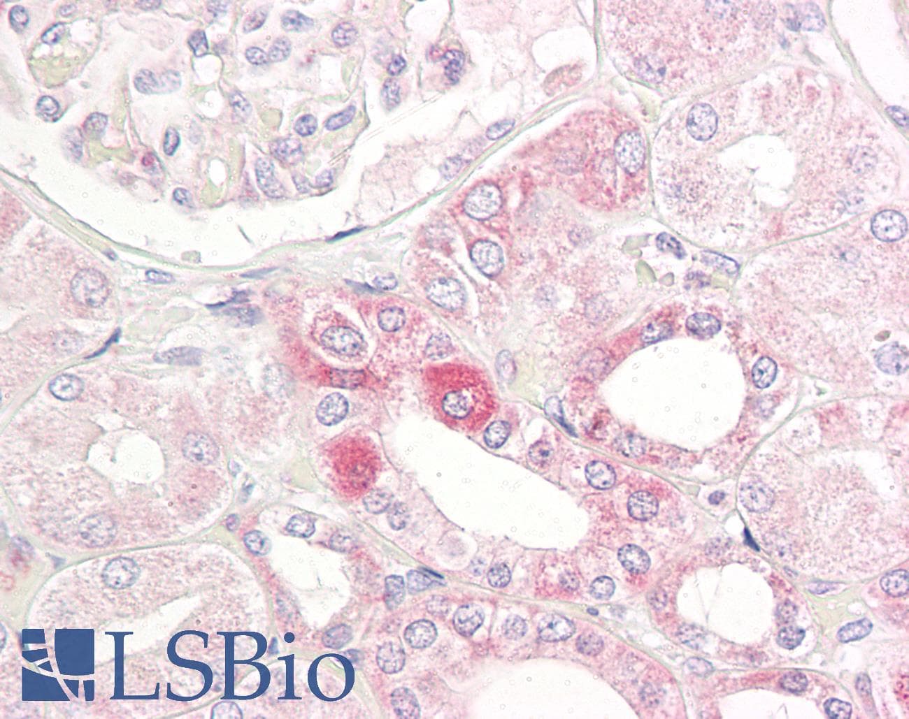 IHC-plus™ PAK1 Antibody (aa165-214)