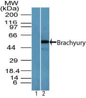 TBXT / T / Brachyury Antibody (aa350-400)